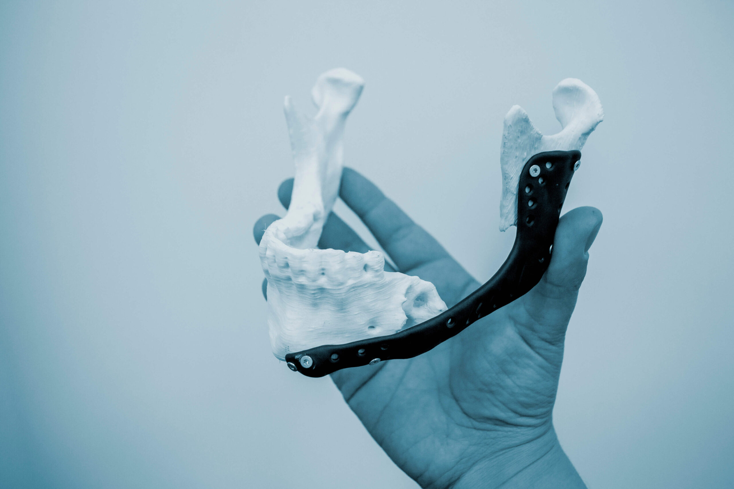 person-holding-hand-3d-printed-plastic-prototype-human-lower-jaw-medical-titanium-implant-closeup-prosthesis-anatomical-bone-3d-printed-from-metal-powder-orthopedic-maxillofacial-prosthesis (1)